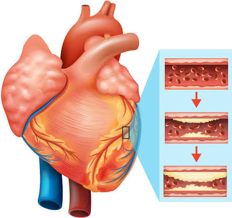 Cardiology