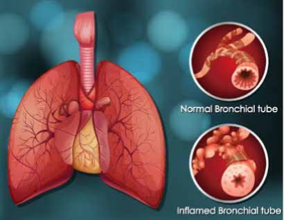 Pulmonology